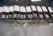 عکس از انتقال خون فارغ از گروه خونی ممکن می‌شود
