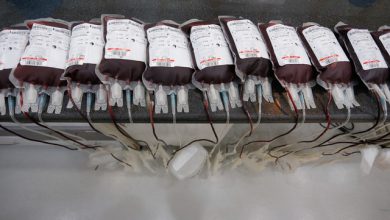 عکس از انتقال خون فارغ از گروه خونی ممکن می‌شود